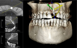 cbct تصویر.<yoastmark class=