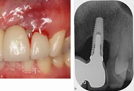 تصویری از دندان<yoastmark class=