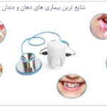 بیماریهای دهان: راهنمای جامع برای شناخت، پیشگیری و درمان