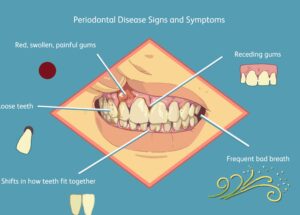 بیماریهای دهان و دندان