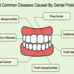 بیماری های لثه : راهنمای جامع برای شناخت، پیشگیری و درمان