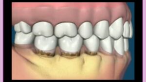 بیماریهای دهان و دندان