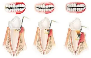 بیماریهای دهان و دندان