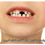 دندانهای شیری هر آنچه باید بدانید