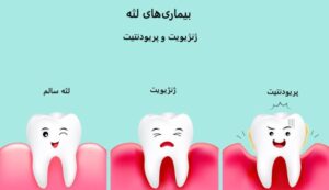 بیماریهای دهان و دندان